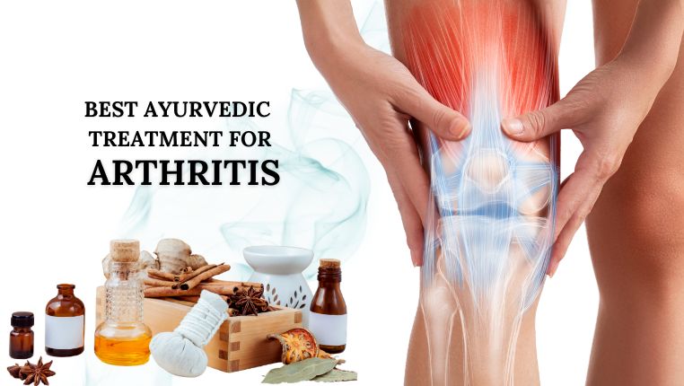 Best Ayurvedic Treatment for Arthritis in India
